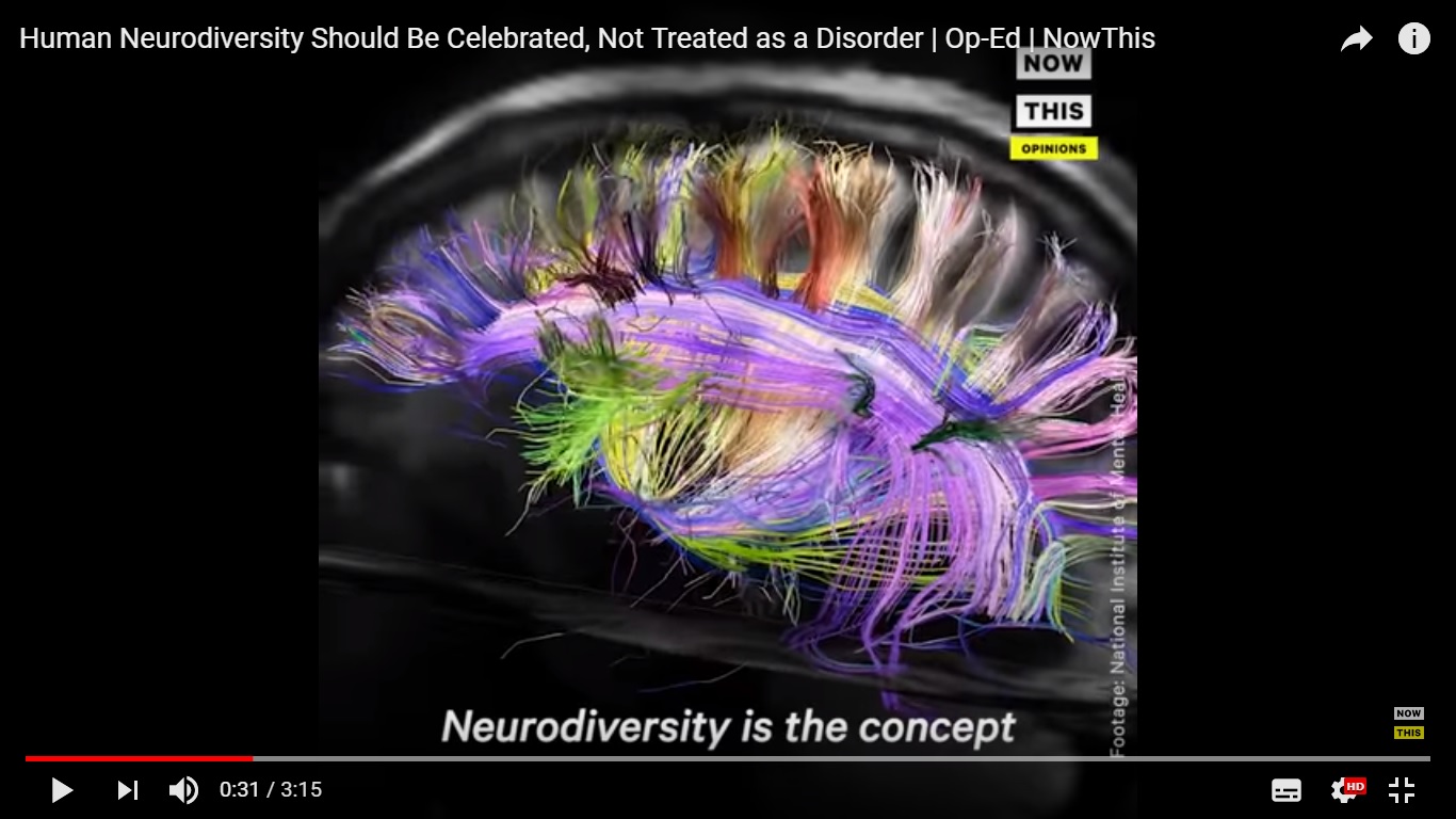Neurodiversidad: el valor del los cerebros diferentes